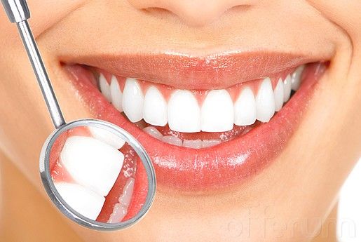 blanqueamiento-dental-contraindicaciones